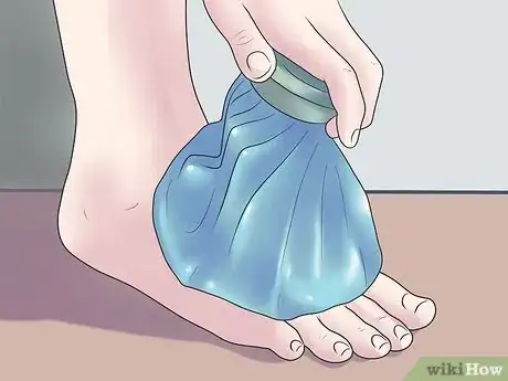 Image titled Treat a Broken Ankle Step 9