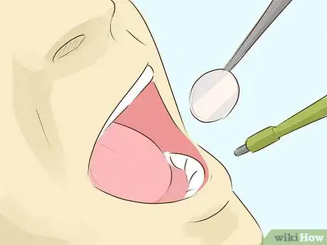 Image titled Treat Oral Cancer Step 1