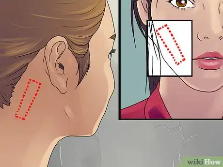 Image titled Get Rid of Cystic Acne Scars Step 12