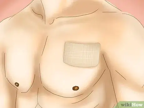 Image titled Undergo Testosterone Therapy Step 5