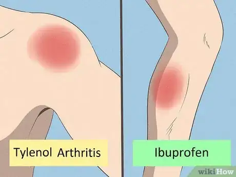 Image titled Take Tylenol Arthritis Step 12