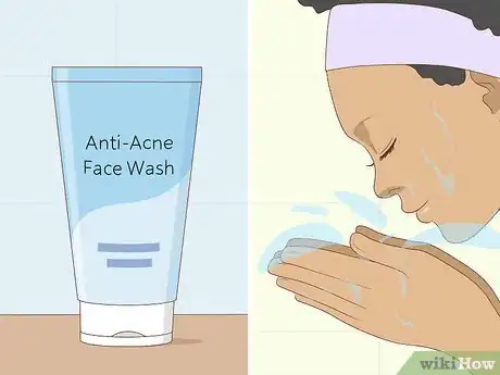 Image titled Treat Adult Acne Step 14