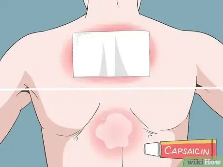 Image titled Alleviate Back Pain Naturally Step 4