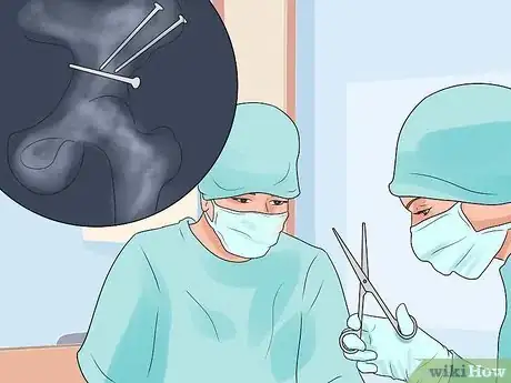 Image titled Align Your Hips Step 13