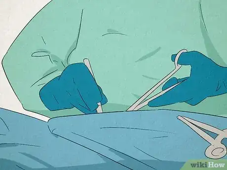 Image titled Get Rid of a Bartholin Cyst Step 8