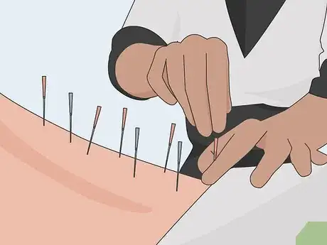 Image titled Treat Colorectal Cancer Step 10