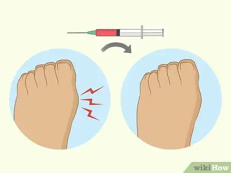 Image titled Treat Vitamin B12 Deficiency Step 14