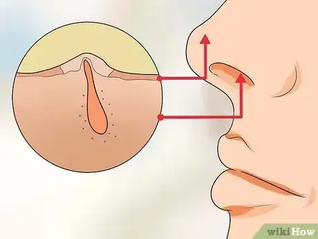 Image titled Treat Ingrown Nose Hairs Step 1