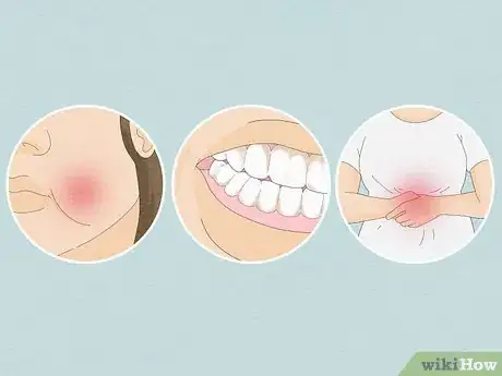 Image titled Diagnose Bulimia Nervosa Step 4