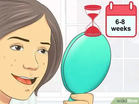 Image titled Not Let Acne Get You Down Step 2