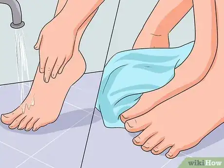 Image titled Cure Nail Fungus Step 14