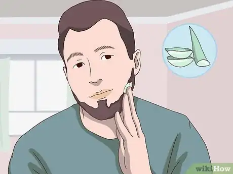 Image titled Reduce Beard Itch Step 5