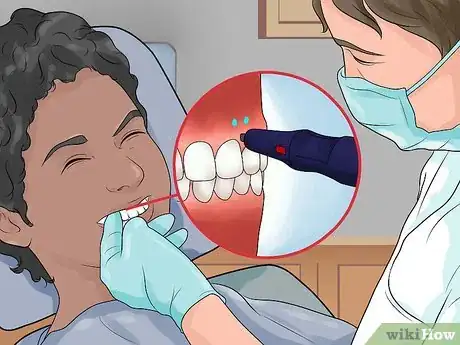 Image titled Avoid Getting Braces Step 7