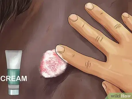Image titled Treat Skin Disorders in Horses Step 14