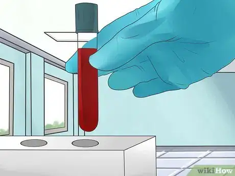 Image titled Test for Kidney Disease Step 4