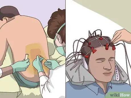 Image titled Diagnose Early Onset Alzheimer's Step 9