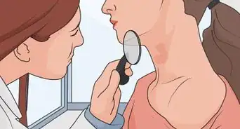 Use Chamomile As a Fungal Treatment