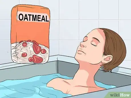 Image titled Avoid Psoriasis Vaccine Complications Step 19