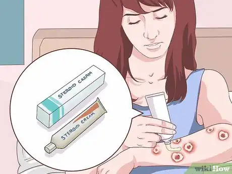 Image titled Handle a Rheumatoid Arthritis Skin Problem Step 19
