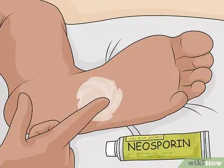 Image titled Treat a Foot Wound Step 22