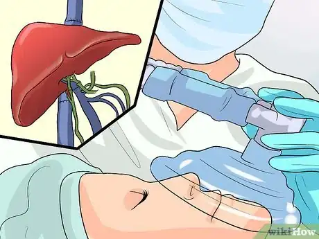 Image titled Get Treatment for Hepatitis C Step 5