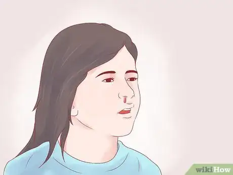 Image titled Deal with a Toddler Nosebleed Step 7