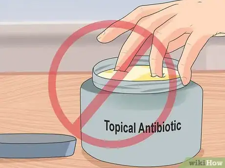 Image titled Use Antibiotics Effectively Step 19