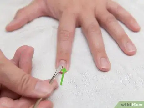 Image titled Make Hands Look Younger Step 5