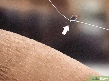 Image titled Remove a Tick from a Horse Step 8