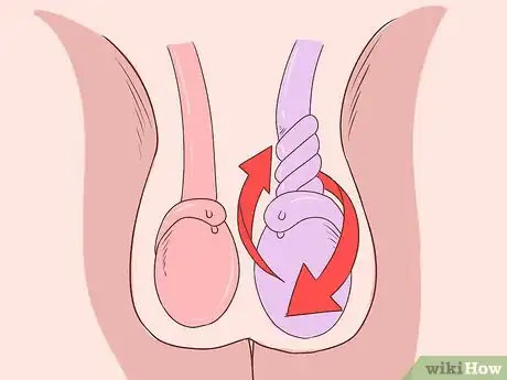 Image titled Treat Pain and Swelling in the Testicles Step 6