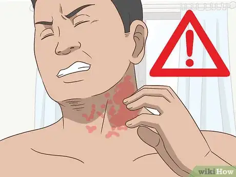 Image titled Treat Both Psoriatic Arthritis and Psoriasis Step 20