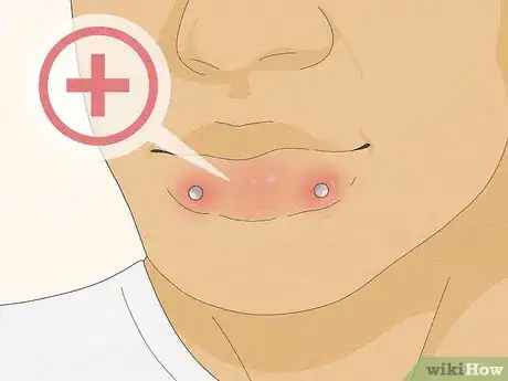 Image titled Get a Labret Piercing Step 17