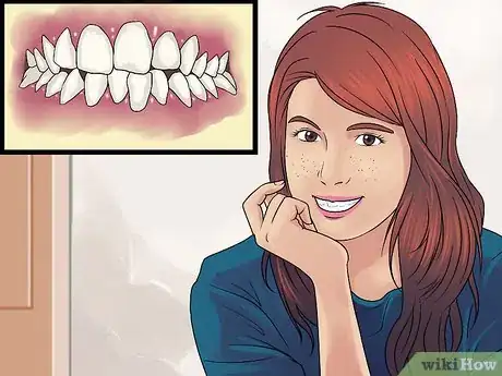 Image titled Get Straight Teeth Without Braces with Invisalign Step 2