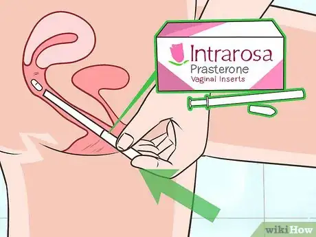 Image titled Treat Dyspareunia Naturally Step 21