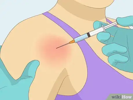 Image titled Identify a Rotator Cuff Injury Step 15