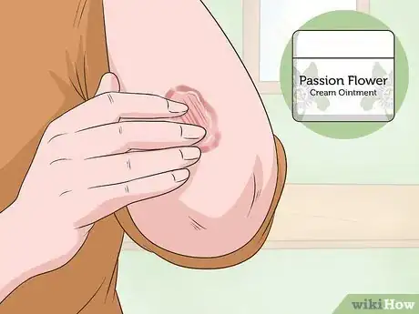 Image titled Use Passion Flower for Health Step 8