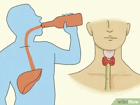 Image titled Treat Macrocytic Anemia Step 5