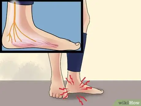 Image titled Diagnose Heel Spurs Step 5