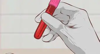 Treat Paget's Disease of the Bone