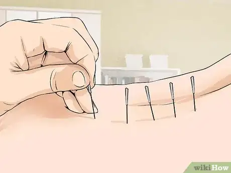 Image titled Stop Back Pain by Relaxing Step 17