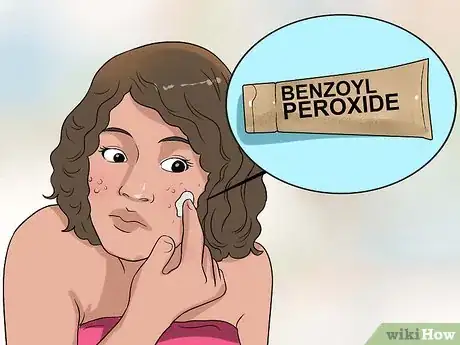 Image titled Clear up Acne With Hydrogen Peroxide Step 5