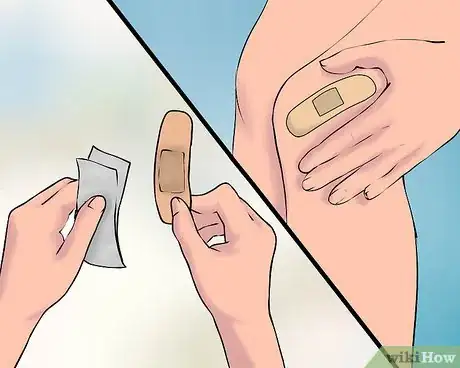 Image titled Use a Band Aid Step 5