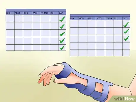 Image titled Cope With a Broken Wrist Step 3