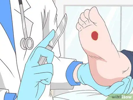 Image titled Heal Foot Ulcers Step 2
