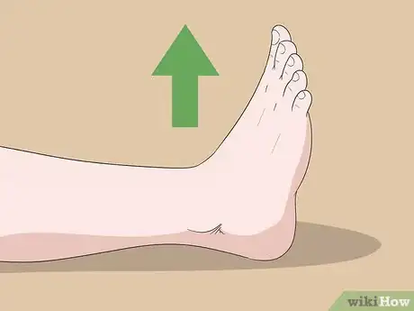 Image titled Wear a Dorsal Night Splint Step 2