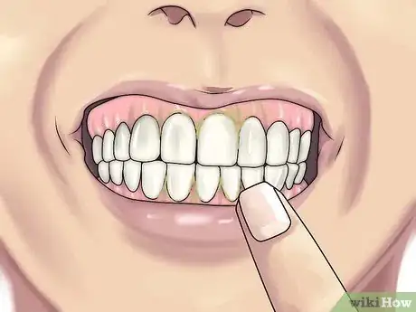 Image titled Prevent Fuzzy Teeth Step 12