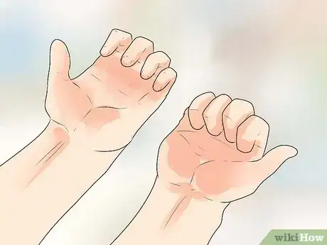 Image titled Exercise With a Broken Wrist Step 15