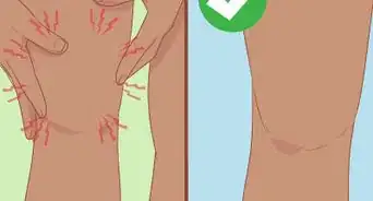 Recover from Overtraining