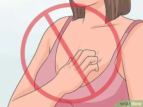 Image titled Treat Itchy Breasts Step 8