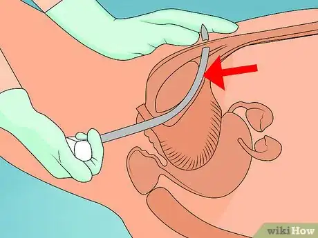 Image titled Avoid Bladder Leaks While Running Step 11